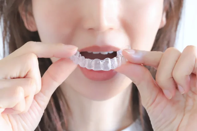 インビザラインの痛みが特に強くなりやすいタイミングはいつ?