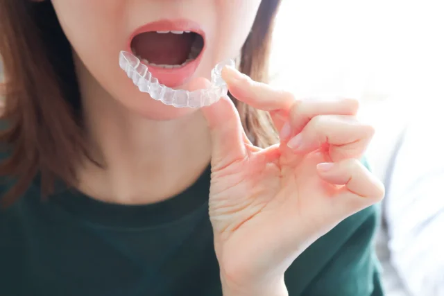 インビザライン中の口内炎対策でやってはいけないことは？