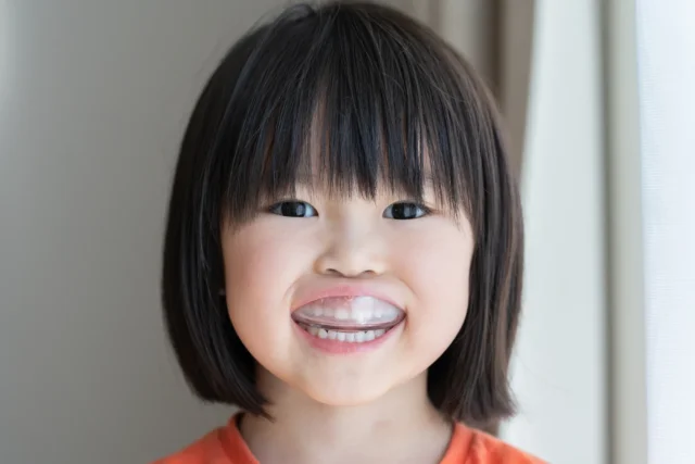 子供の矯正でマウスピースとワイヤーはどう違う？