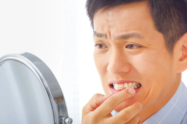 インビザラインGoで起こりうる失敗の種類