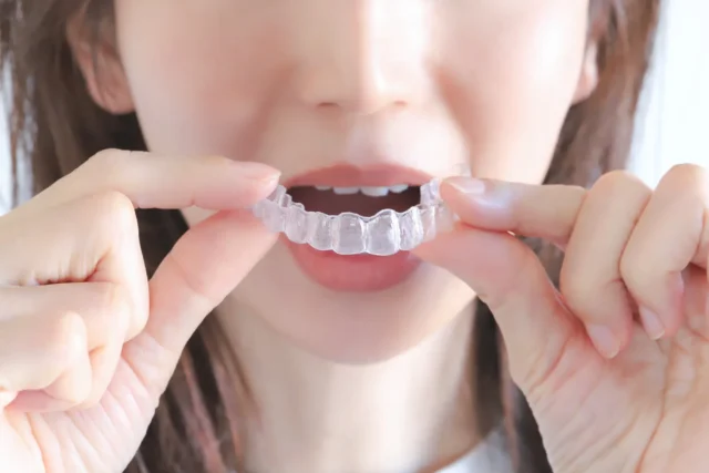 出っ歯治療の視点でのインビザラインGoとコンプレヘンシブの違い