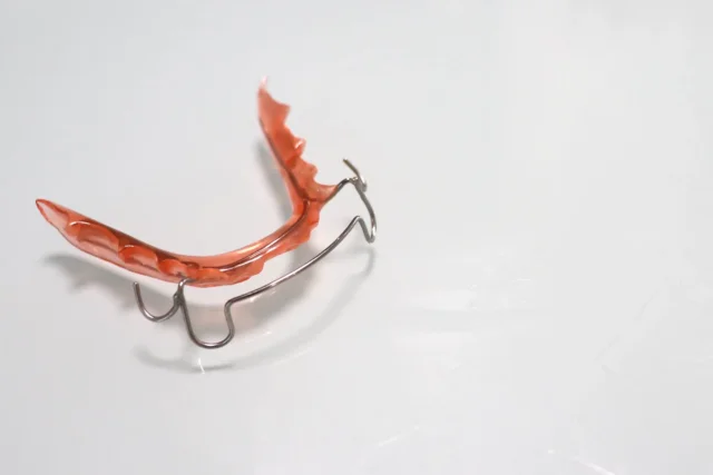 インビザラインGoで発生する追加費用の目安