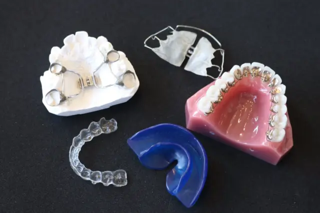 インビザライン vs ワイヤー矯正比較【10代・II期治療】