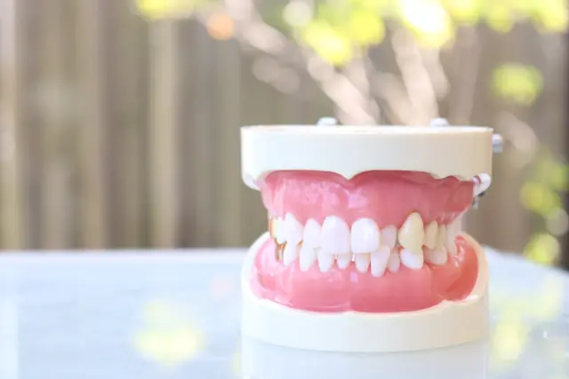 インビザラインは「おすすめしない」と言われやすい症例とは？